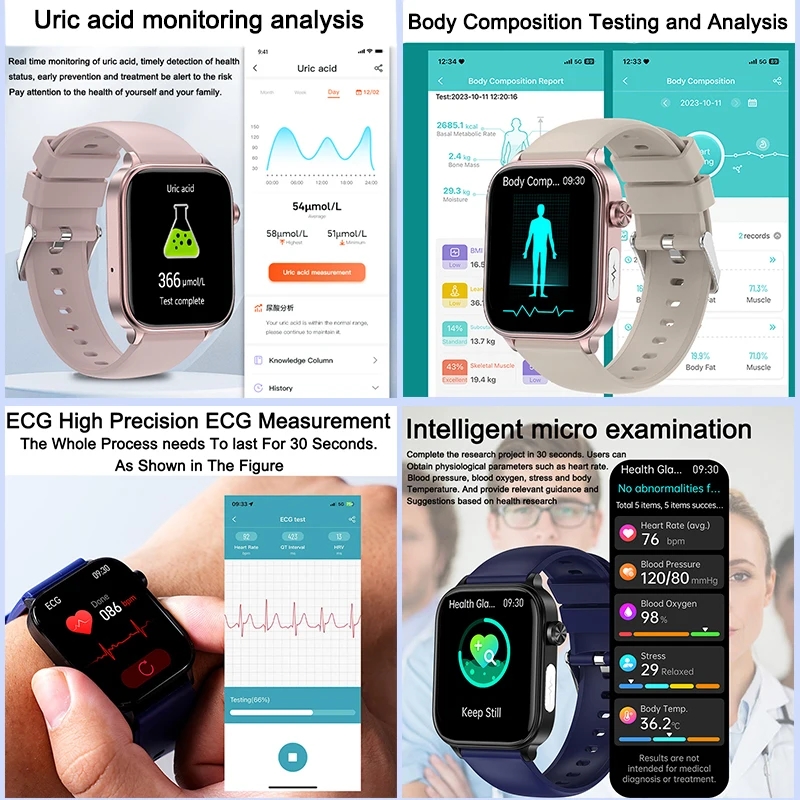 2025 Yeni XIAOM1 EKG+PPG Kan Y - Smartwatch New Watches For Women incelemesi ve fiyatı